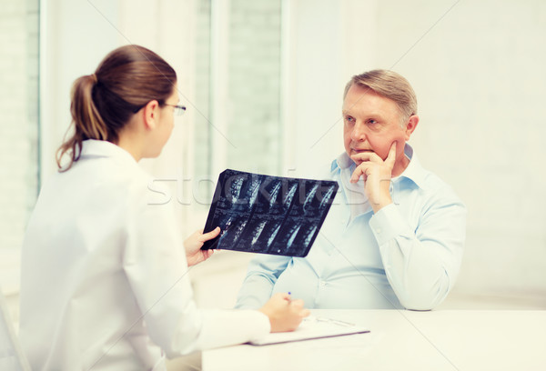 [[stock_photo]]: Homme · médecin · vieillard · regarder · xray · santé