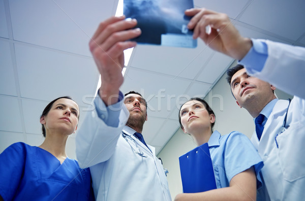 Grup doktorlar bakıyor xray taramak görüntü Stok fotoğraf © dolgachov
