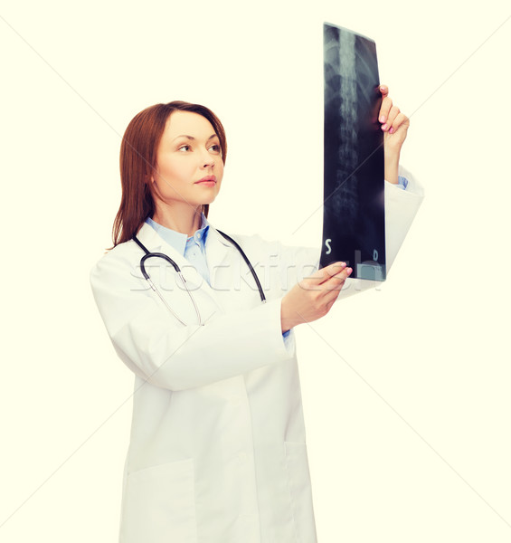 Foto stock: Grave · femenino · médico · mirando · Xray · salud