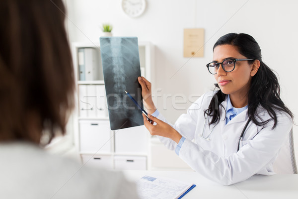 doctor with x-ray of spine and patient at hospital Stock photo © dolgachov