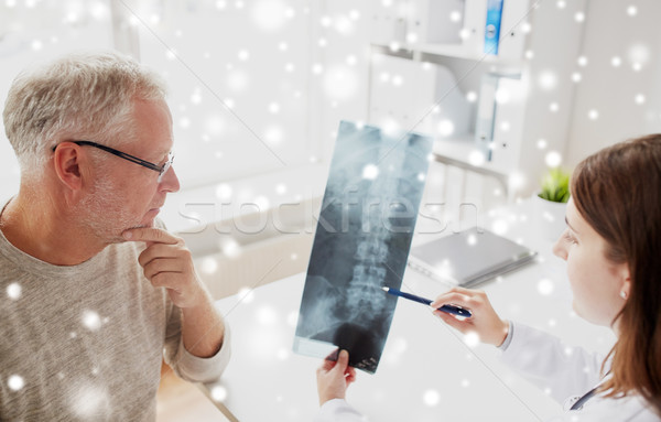 Stock fotó: Orvos · gerincoszlop · röntgen · idős · férfi · kórház