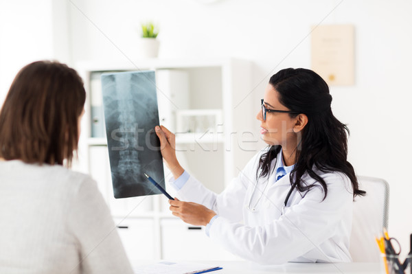 doctor and patient with spine x-ray at hospital Stock photo © dolgachov