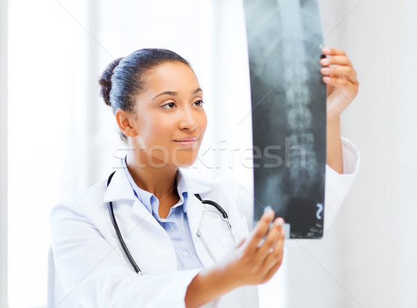 African medic uita Xray asistenţă medicală medical Imagine de stoc © dolgachov