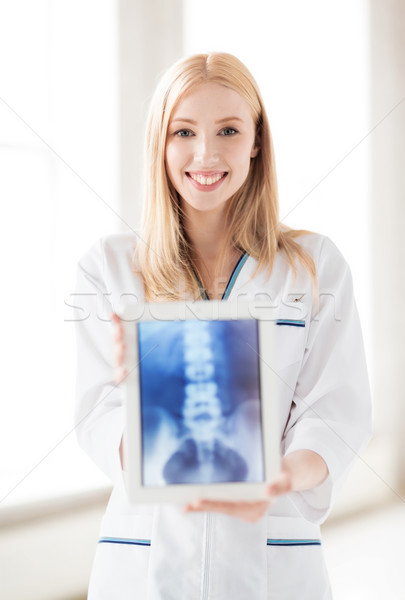 female doctor with x-ray on tablet pc Stock photo © dolgachov