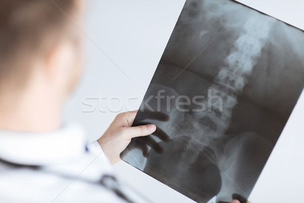 doctor holding x-ray or roentgen image Stock photo © dolgachov