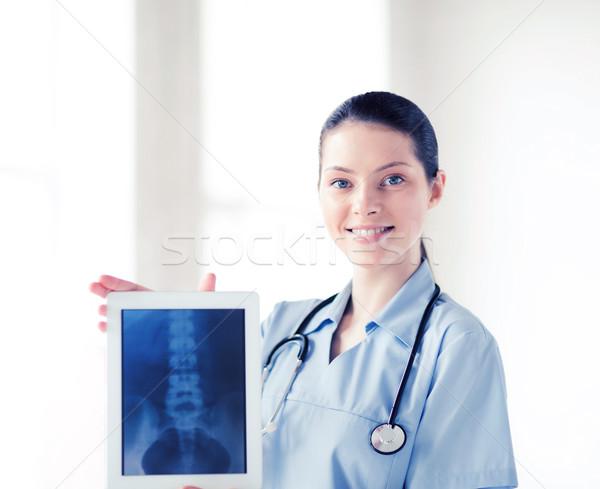 female doctor with x-ray on tablet pc Stock photo © dolgachov