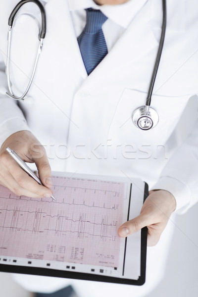 Mężczyzna lekarz ręce kardiogram jasne zdjęcie rodziny Zdjęcia stock © dolgachov