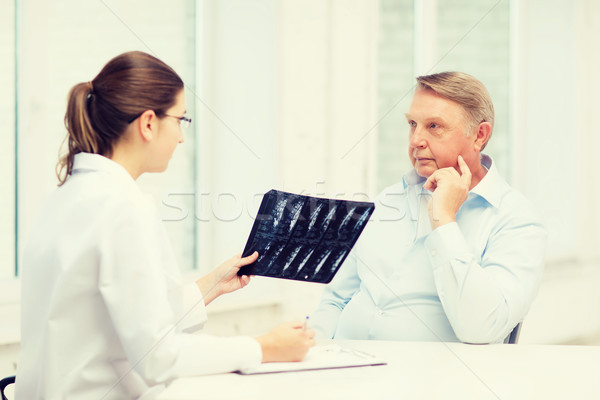 Foto d'archivio: Femminile · medico · vecchio · guardando · Xray · sanitaria