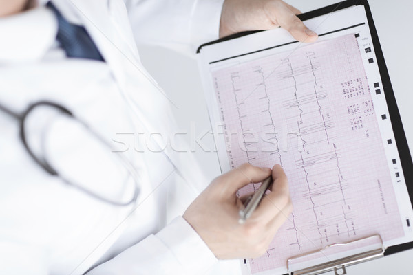 Mannelijke arts handen kardiogram heldere foto familie Stockfoto © dolgachov