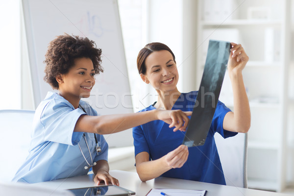 Stockfoto: Gelukkig · vrouwelijke · artsen · Xray · afbeelding · ziekenhuis