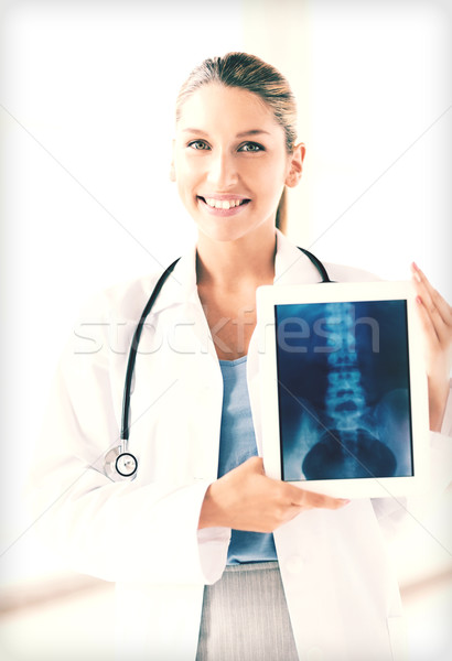 female doctor with x-ray on tablet pc Stock photo © dolgachov