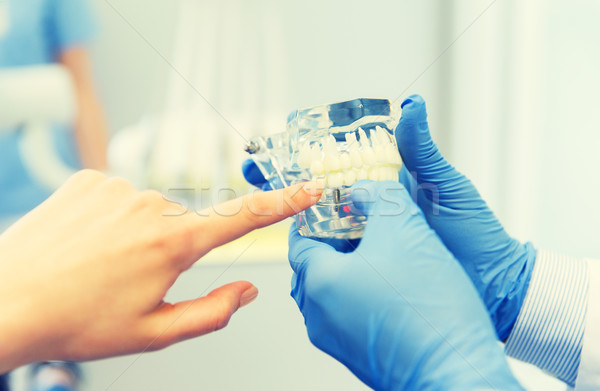 close up of dentist hands with teeth or jaw model Stock photo © dolgachov