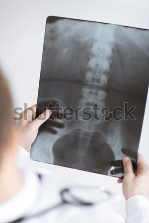 Medico Xray immagine medico di sesso maschile Foto d'archivio © dolgachov