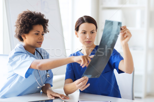 Сток-фото: женщины · врачи · Xray · изображение · больницу · радиология