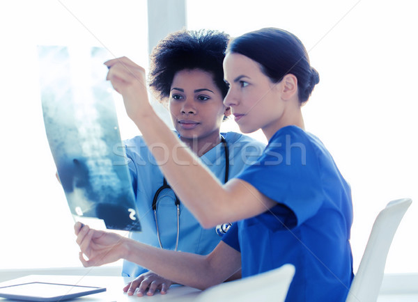 doctors with x-ray image of spine at hospital Stock photo © dolgachov