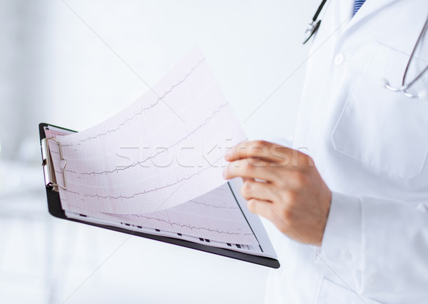 Mężczyzna lekarz ręce kardiogram jasne zdjęcie Zdjęcia stock © dolgachov