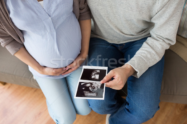 關閉 情侶 嬰兒 超聲 懷孕 商業照片 © dolgachov