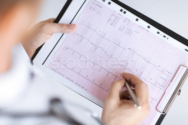 male doctor hands with cardiogram Stock photo © dolgachov