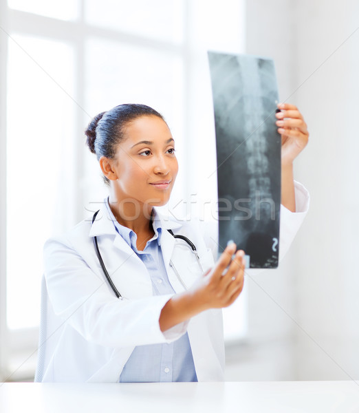 Afrikai orvos néz röntgen egészségügy orvosi Stock fotó © dolgachov