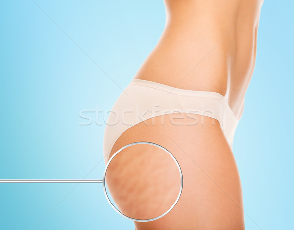 close up of woman buttocks with cellulite Stock photo © dolgachov