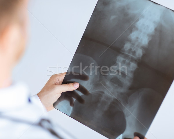 doctor holding x-ray or roentgen image Stock photo © dolgachov