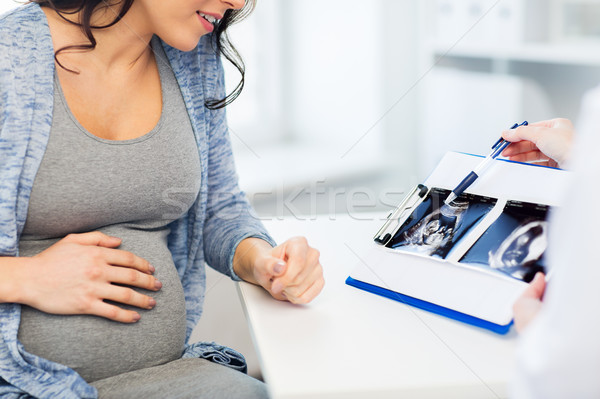 close up of doctor and pregnant woman ultrasound Stock photo © dolgachov