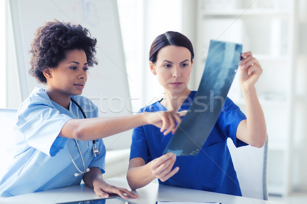 female doctors with x-ray image at hospital Stock photo © dolgachov