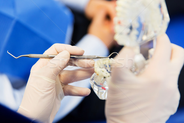 Stock photo: close up of dentist with teeth and dental probe