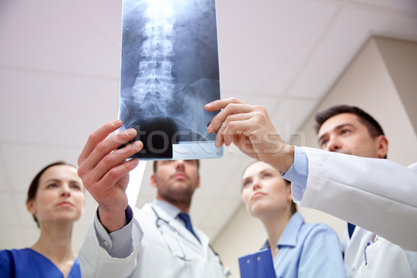 group of medics with spine x-ray scan at hospital Stock photo © dolgachov