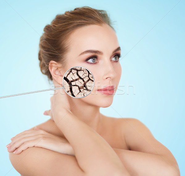 woman face with dehydrated cracked dry skin Stock photo © dolgachov