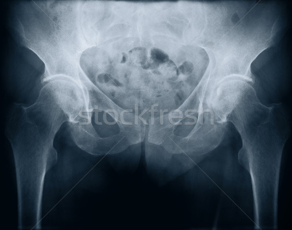 x-ray with bolt Stock photo © donatas1205