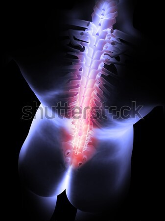 Stock photo: 3d rendered anatomy illustration of painful back