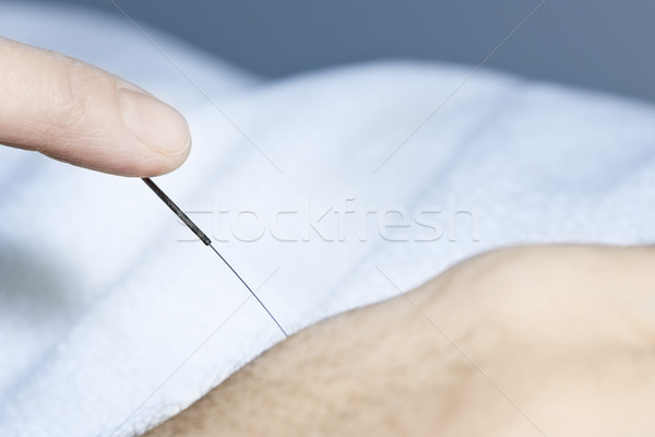 Acupuncture needle in skin Stock photo © elenaphoto