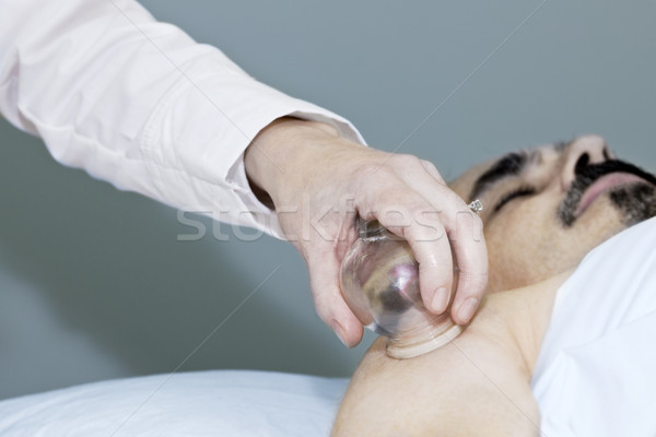 Cupping therapy in traditional chinese medicine Stock photo © elenaphoto