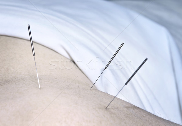 Acupunctuur naalden schouder geneeskunde ontspannen Stockfoto © elenaphoto
