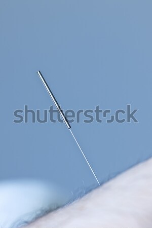 Acupuncture needle in skin Stock photo © elenaphoto