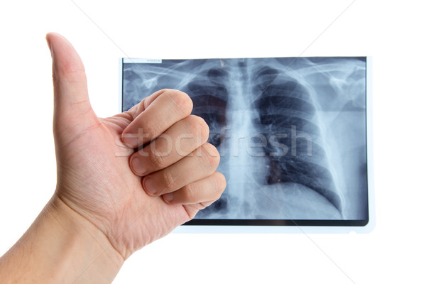 Férfi kéz mutat remek tüdő röntgenkép Stock fotó © Elisanth