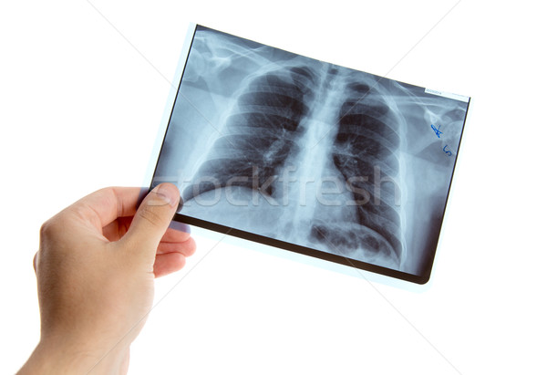 Männlich Hand halten Lunge Radiographie isoliert Stock foto © Elisanth