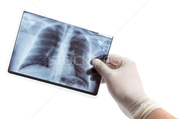 Férfi kéz orvosi kesztyű tart tüdő Stock fotó © Elisanth