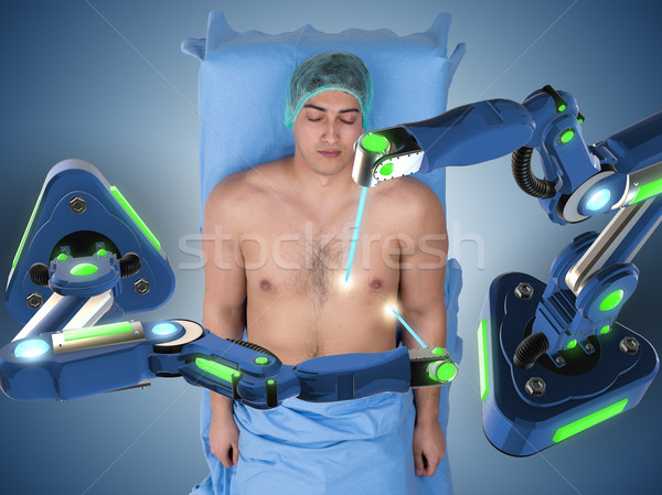 The surgery performed by robotic arm Stock photo © Elnur