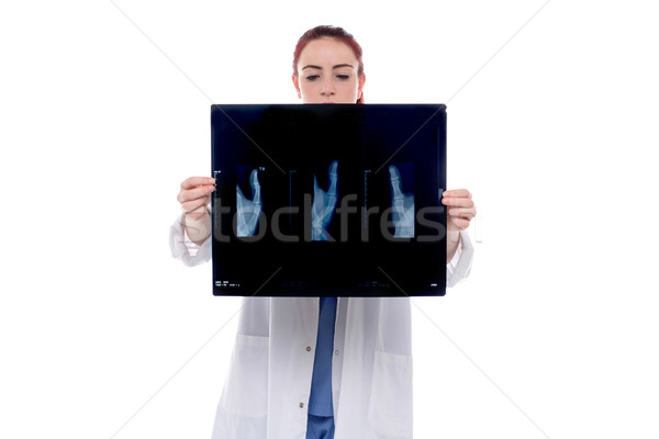 Stock foto: Weiblichen · Arzt · xray · jungen · stehen · Hand · in · Hand