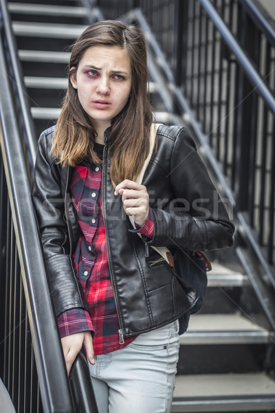 Stock photo: Young Bruised and Frightened Girl With Backpack on Staircase