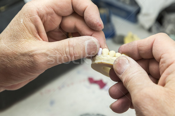 Dental tecnico lavoro 3D stampata muffa Foto d'archivio © feverpitch