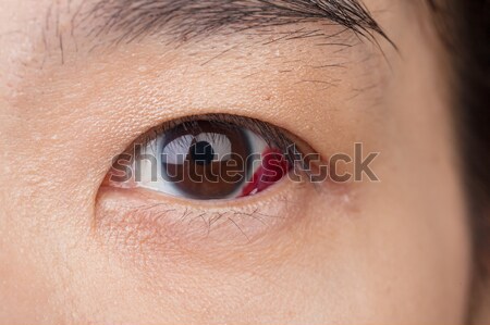Oeil blessure infecté saine macro Photo stock © FrameAngel