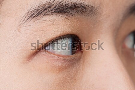 Eye injury or infected for healthy concept, macro closeup  Stock photo © FrameAngel
