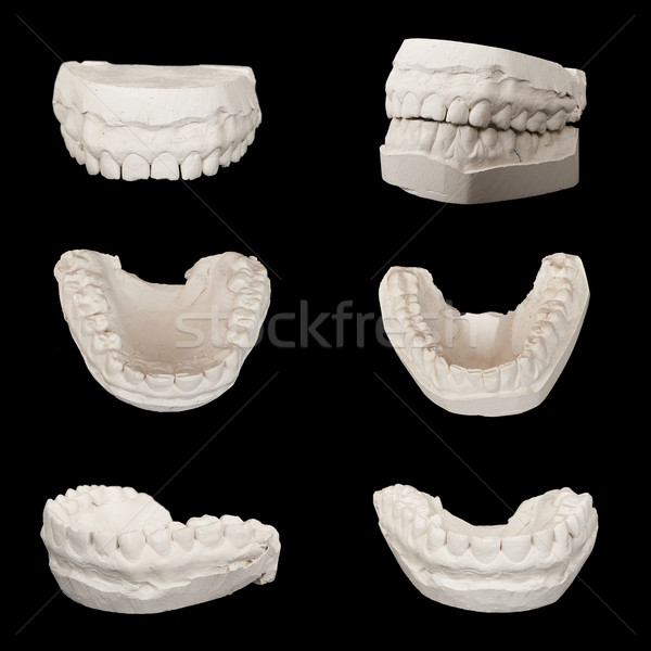 Set of Dental casting gypsum models plaster cast stomatologic hu Stock photo © frescomovie