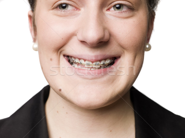 girl with bracers Stock photo © gemenacom