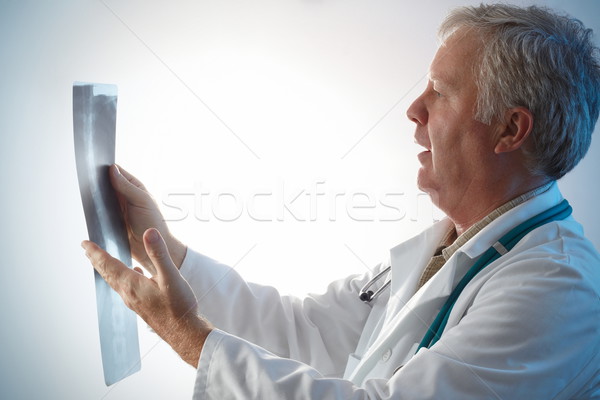 Xray lekarza niespodzianką pacjenta film świetle Zdjęcia stock © georgemuresan
