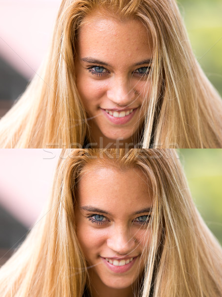 young beautiful girl before and after spots Stock photo © Giulio_Fornasar