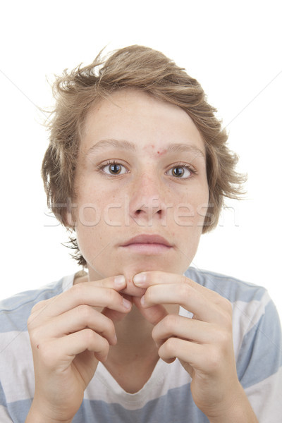 Stockfoto: Puberteit · acne · kid · gezicht · teen